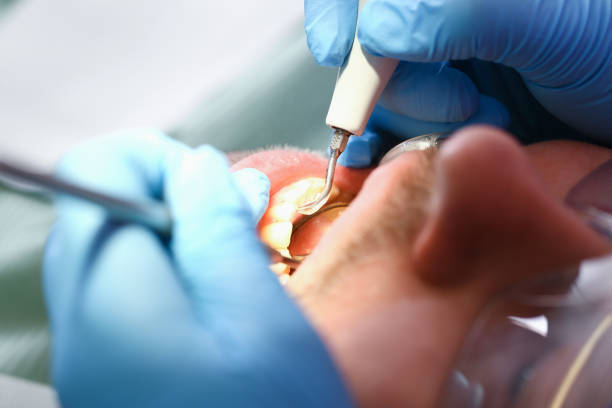 Best Pediatric Emergency Dentist in West Concord, MA